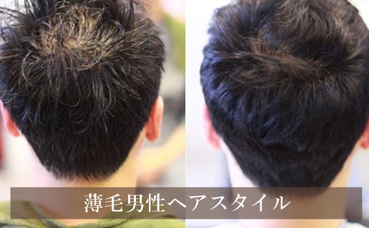 薄毛男性のヘアスタイル14選 カッコよくなる5つのポイント 髪の毛log