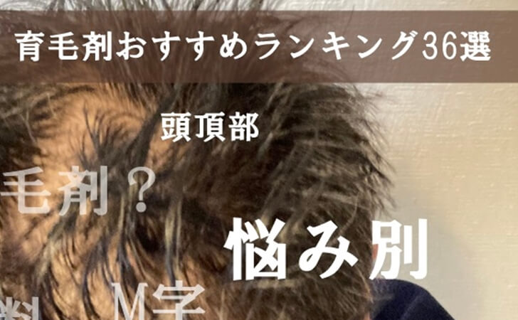 スキンヘッドが似合う日本人の条件 芸能人を参考に メンズ髪型log